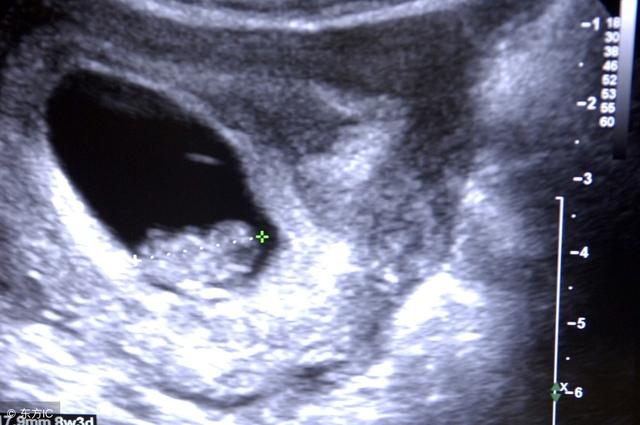 怀孕十三周，孩子的生殖器官长全了吗？有什么科学依据